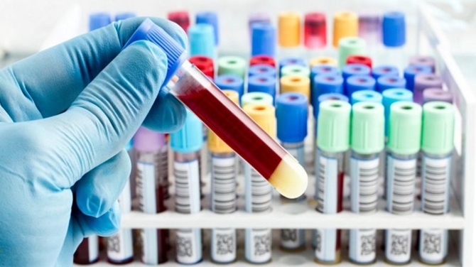 Wissenschaftler haben ein „Elixier der Jugend“ entwickelt 1