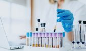 Scientists have developed an “elixir of youth”