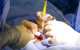 Как правильно выбрать оборудование для электрохирургии и каким оно должно быть