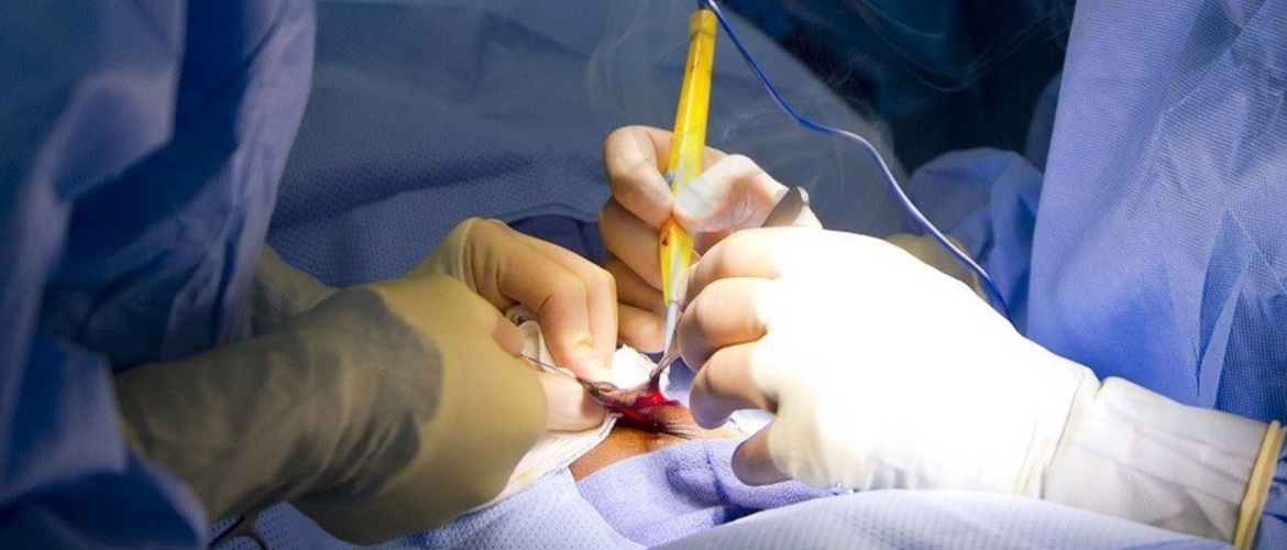 Как правильно выбрать оборудование для электрохирургии и каким оно должно быть