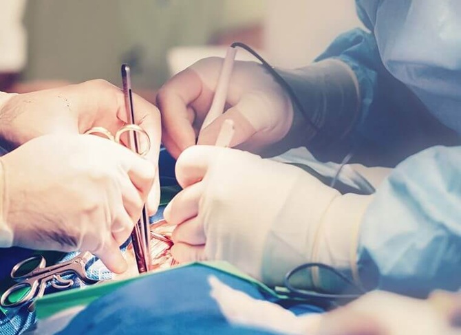 Как правильно выбрать оборудование для электрохирургии и каким оно должно быть 1