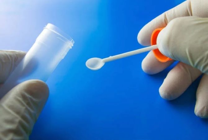 Когда организм подает сигналы тихо: что может рассказать обычный анализ кала 2