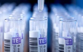 Інфекційна діагностика: ключові аналізи на гепатити та кір