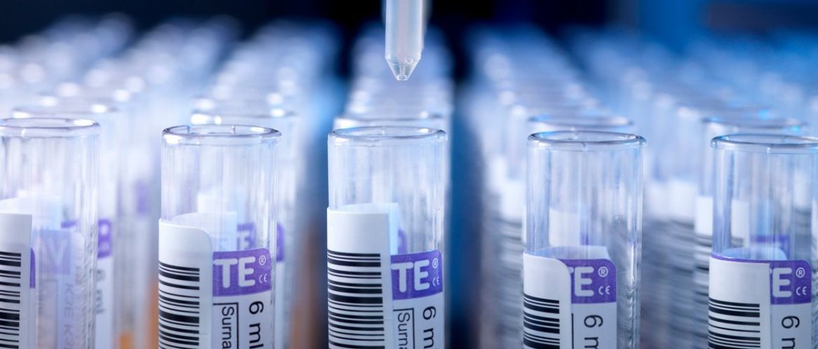 Інфекційна діагностика: ключові аналізи на гепатити та кір