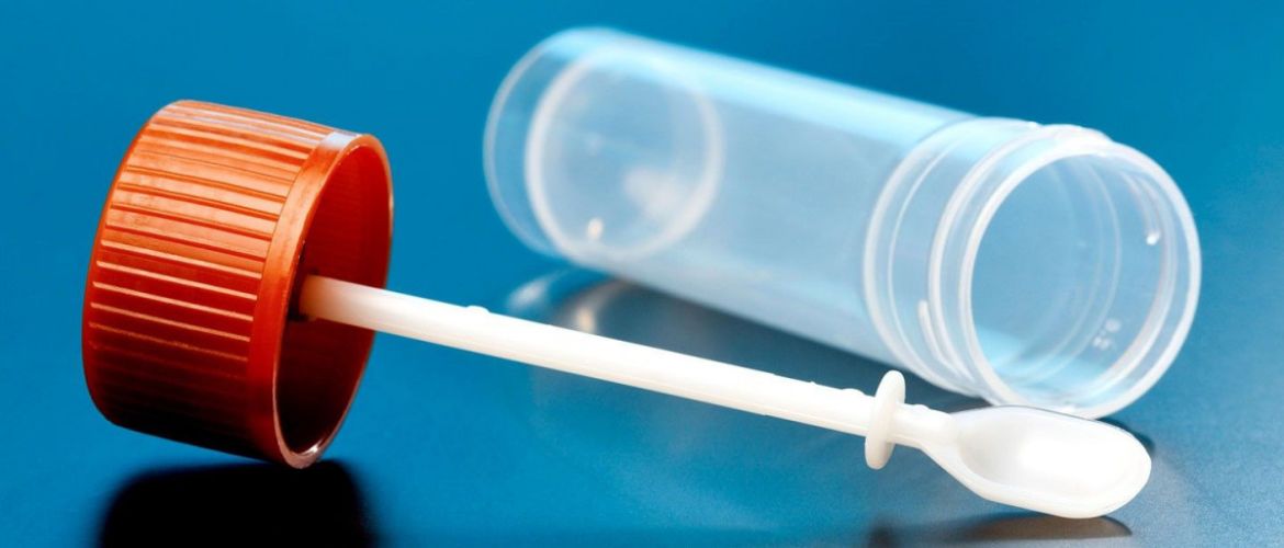 Когда организм подает сигналы тихо: что может рассказать обычный анализ кала