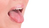 Особливості лікування стоматиту