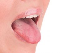 Особливості лікування стоматиту