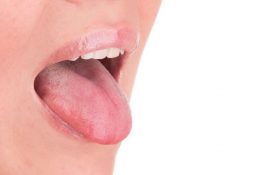 Особливості лікування стоматиту