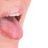 Особливості лікування стоматиту