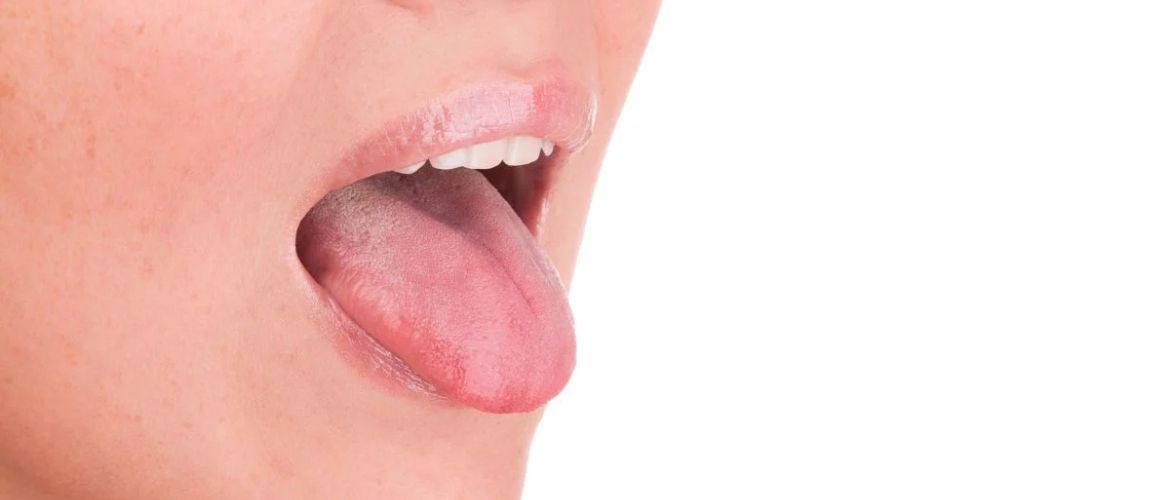 Особливості лікування стоматиту