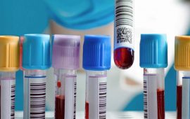 Аналізи крові – коли потрібно проводити лабораторну діагностику та чому вона важлива