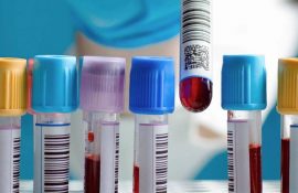 Аналізи крові – коли потрібно проводити лабораторну діагностику та чому вона важлива