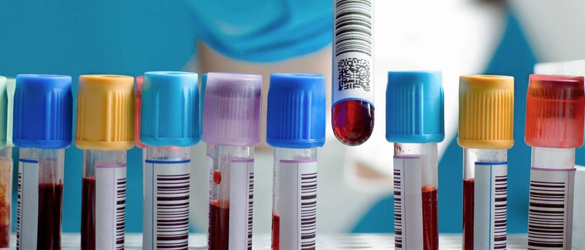 Аналізи крові – коли потрібно проводити лабораторну діагностику та чому вона важлива
