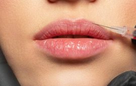 Натуральні губи та сучасна ботулінотерапія: як досягти гармонії без перебільшень