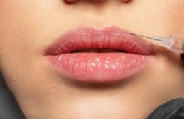 Натуральні губи та сучасна ботулінотерапія: як досягти гармонії без перебільшень
