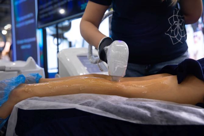 Діодний лазер для епіляції нового покоління PrimeLaser — ефективний апарат лазерної епіляції для професіоналів 1