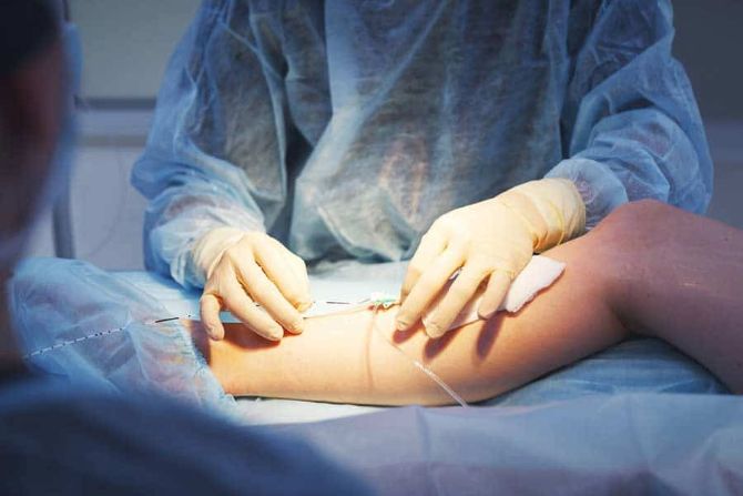 Лазерне видалення вен у Вінниці