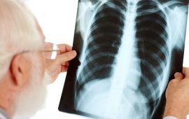 Флюорография в 2 проекциях: зачем нужна и чем отличается от обычной