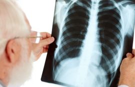 Флюорография в 2 проекциях: зачем нужна и чем отличается от обычной