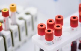 Аналіз на пролактин – коли він потрібен та як його проводять