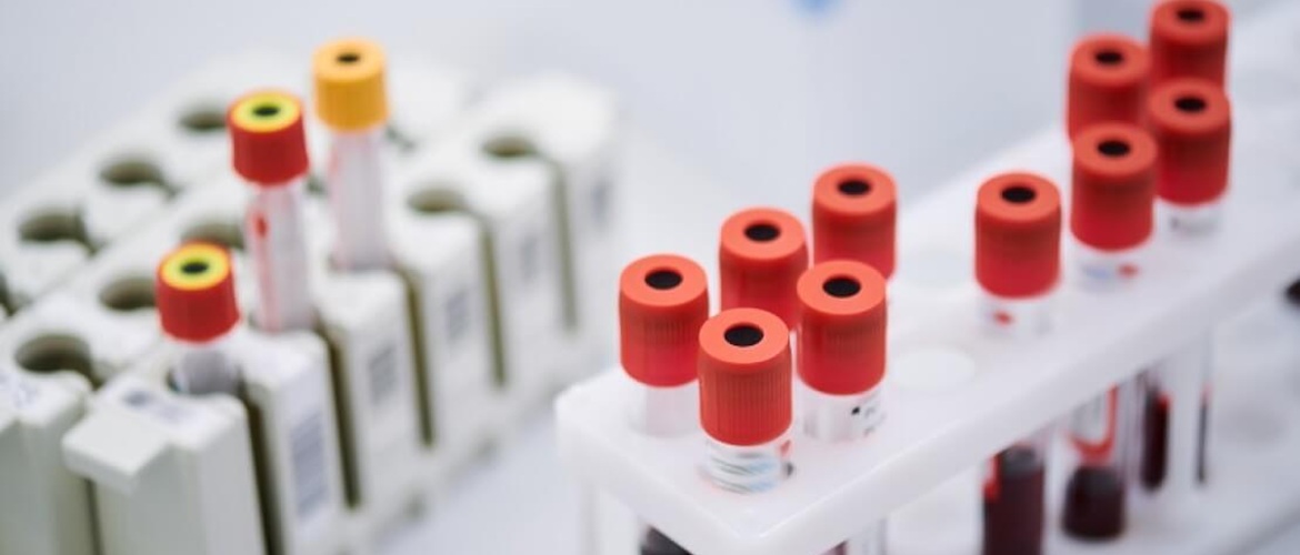 Аналіз на пролактин – коли він потрібен та як його проводять