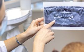 Тривимірне сканування щелепи: коли важлива точність