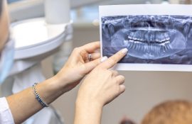 Тривимірне сканування щелепи: коли важлива точність