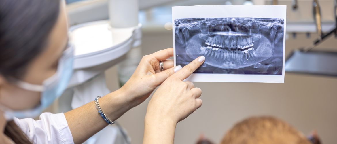 Тривимірне сканування щелепи: коли важлива точність