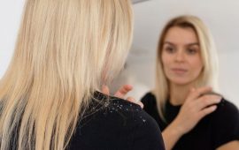 Лупа чи себорейний дерматит: як відрізнити і що реально допомагає