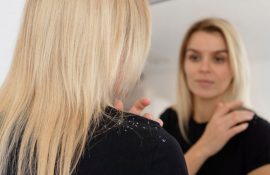 Лупа чи себорейний дерматит: як відрізнити і що реально допомагає