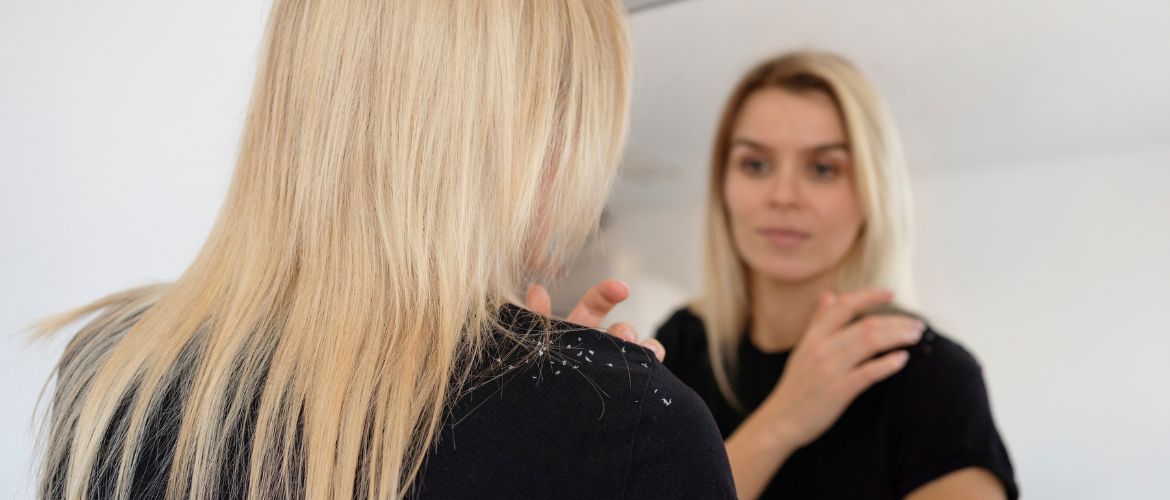 Лупа чи себорейний дерматит: як відрізнити і що реально допомагає